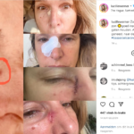 Lucille Werner | Neus.nu | Platform van KNO-artsen