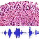 Ontregeld slijmvlies met audio Ontregeld slijmvlies