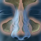 Sinusitis Surgery | Neus.nu | Platform van KNO-artsen